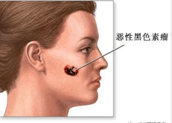 圖片3.png